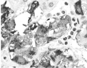自噬基因Beclin-1 自噬基因Beclin-1