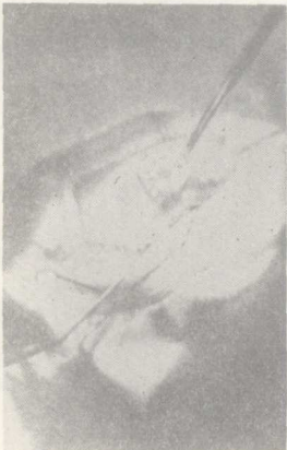 3.2.6 3.2.6