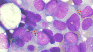 http://www.the-scientist.com/images/News/April2014/310AML.PNG