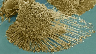 http://www.the-scientist.com/images/Nutshell/April2014/autophagy%20full.jpg