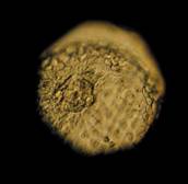http://www.nature.com/polopoly_fs/7.31094.1446825072!/image/embryo.jpg_gen/derivatives/landscape_300/embryo.jpg